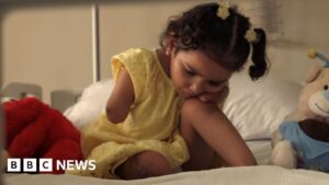 BBC joins injured Gazan children as they arrive in Jordan