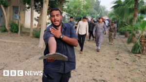BBC cameraman haunted by Gaza’s malnourished children injured in Israeli strike